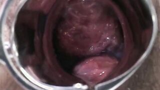 Hot Preggy Beauty with male nurses & doc love to suck cocks.